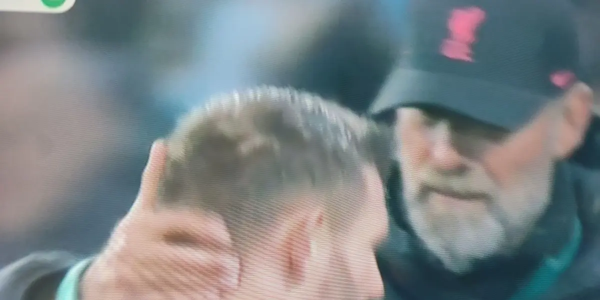 The Reds' veteran midfielder was out of the Carabao Cup with fitness problems